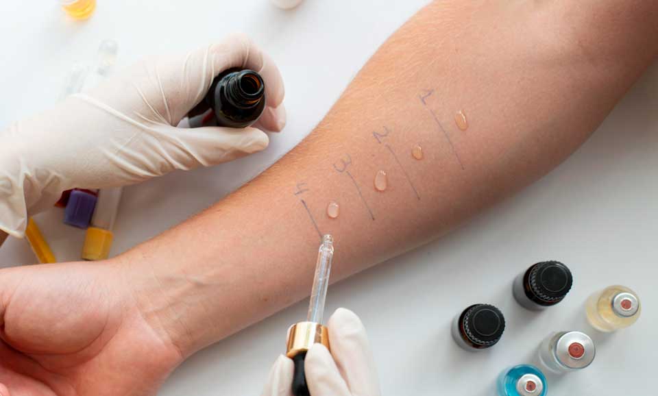 Alergologie - Red Medical Center